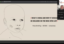 Press Release on Noma Disease